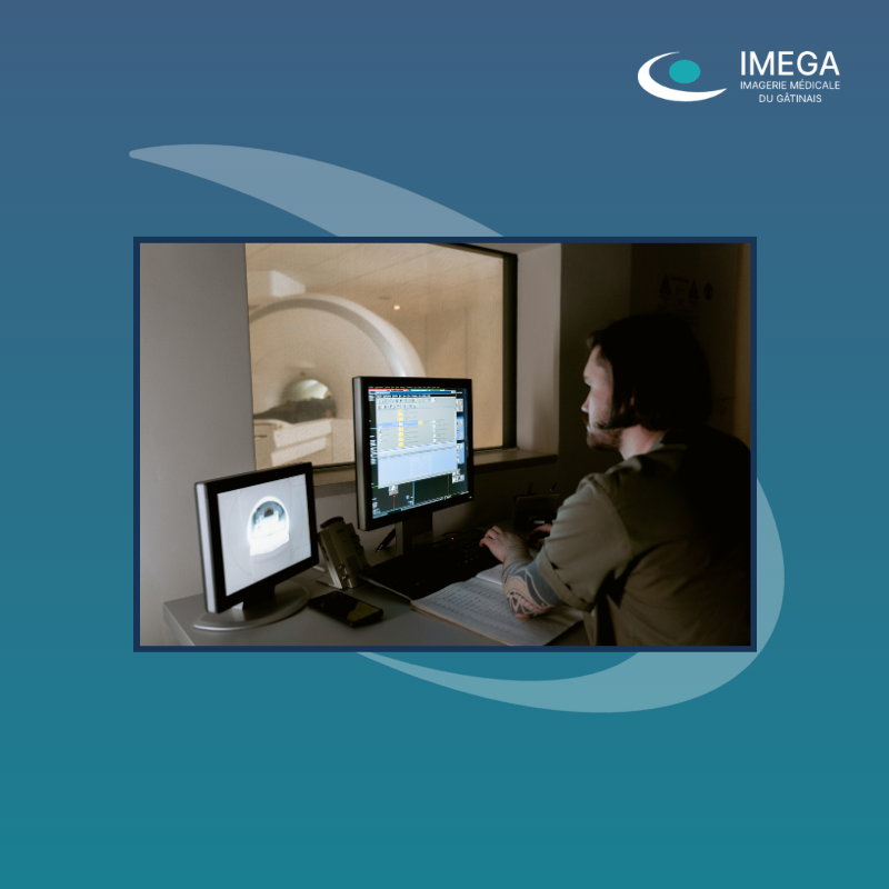 GABARITS BLOG – IMEGA